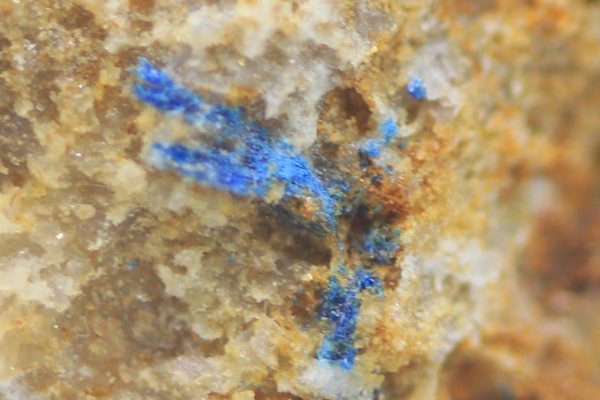 Frostite
