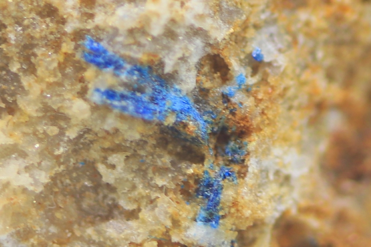 Frostite